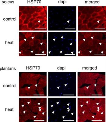 Nuclear Accumulation of HSP70 in Mouse Skeletal Muscles in Response to Heat Stress, Aging, and Unloading With or Without Reloading